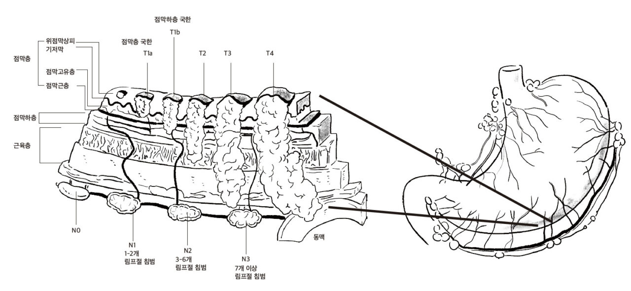 메디컬 일러스트