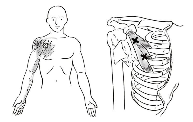 메디컬 일러스트